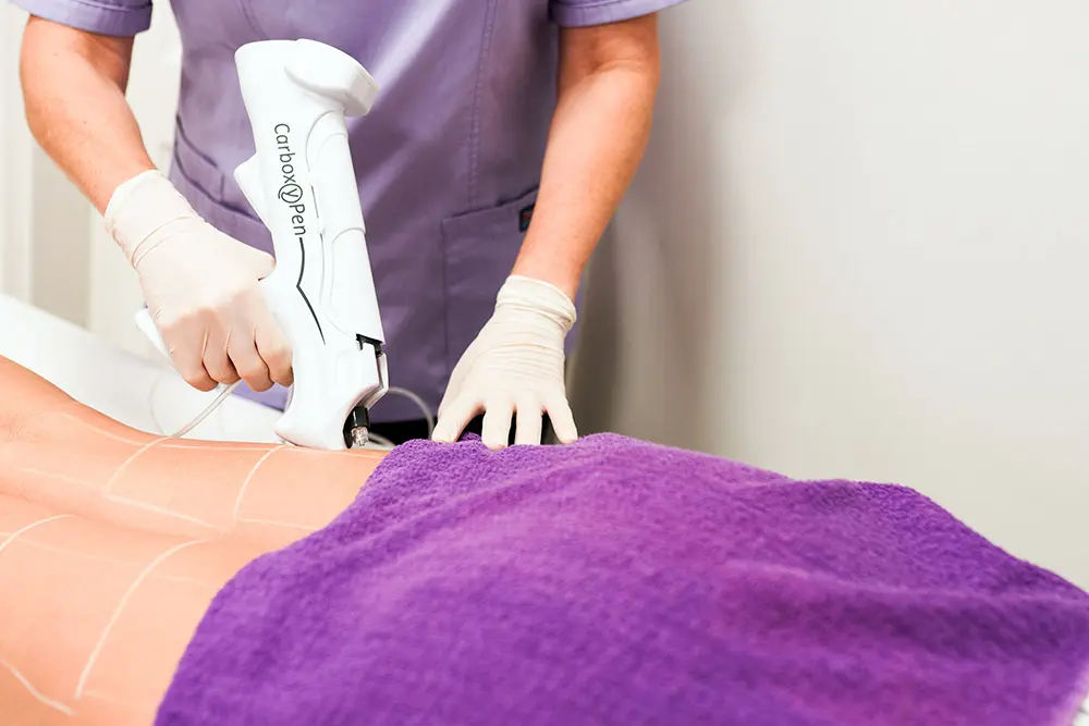 Tratamientos corporales en Tenerife Sur para remodelar, reafirmar y mejorar la apariencia de la piel en Clínica Bajo, Los Cristianos